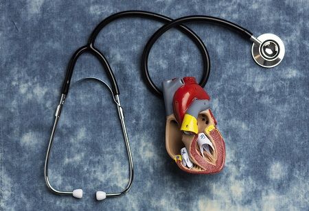  Abbott, AVEIR DR, dual chamber leadless pacemaker