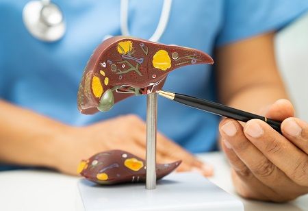  The Trial That Could Reshape Zydus' MASH Story India Pharma Outlook 