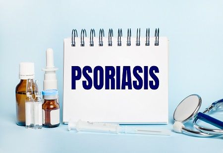  Plaque Psoriasis Gets a New Treatment Option in India, India Pharma Outlook