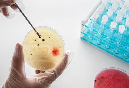  Leucine Rich Bio Launches Vaginal Microbiome Test in India India Pharma Outlook