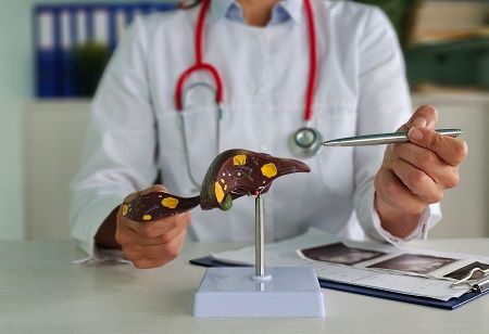  Novartis MS Pill: How does Rhapsido avoid liver toxicity?, India Pharma Outlook