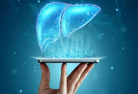 Apollo partners with Siemens for AI-driven liver health innovation