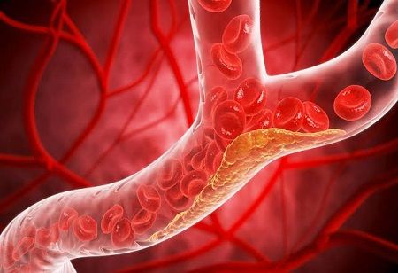  Papaya Leaf Extract Promises in Easing Chemo Side Effects India Pharma Outlook