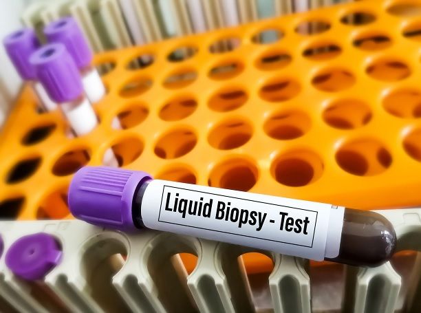 Liquid Biopsy Test, India Pharma Outlook