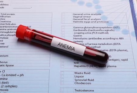  Government Strengthens Anaemia Fight With New 7x7x7 Strategy, India Pharma Outlook