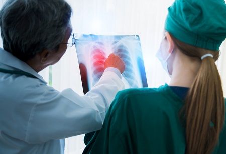  TB Screening Finds 7 Lakh Cases, Nadda Urges MPs to Step Up, India Pharma Outlook