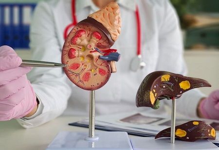 Novartis' Fabhalta Proves Strong Kidney Protection in IgAN