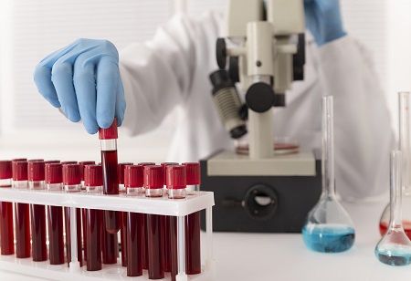  WHO, multiplex testing, HIV, viral hepatitis